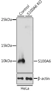 WB analysis of normal (control) and knockout (KO) HeLa cell lysate using GTX64584 S100A6 antibody. Dilution : 1:1000 Loading : 25microg per lane
