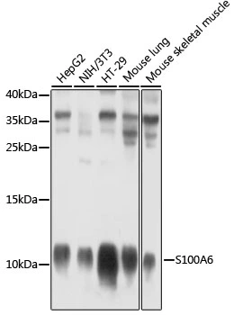 WB analysis of various sample lysates using GTX64584 S100A6 antibody. Dilution : 1:1000 Loading : 25microg per lane