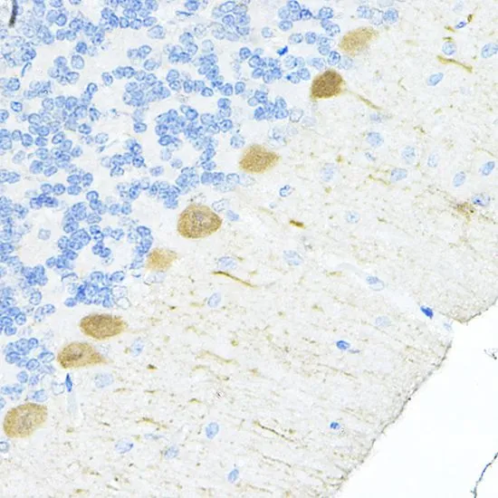 IHC-P analysis of rat cerebellum tissue using GTX64584 S100A6 antibody. Dilution : 1:100