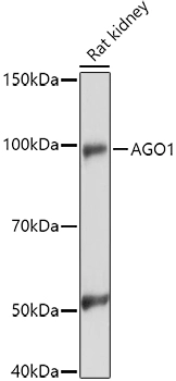 WB analysis of rat kidney tissue lysate using GTX64586 AGO1 antibody. Loading : 25 microg Dilution : 1:1000 WB analysis of rat kidney tissue lysate using GTX64586 AGO1 antibody. Loading : 25 microg Dilution : 1:1000