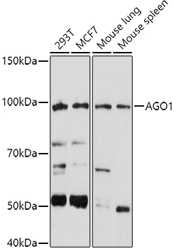 WB analysis of various samples using GTX64586 AGO1 antibody. Loading : 25 microg Dilution : 1:1000