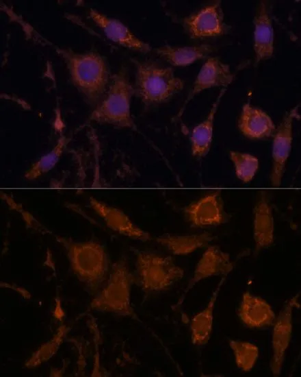 ICC/IF analysis of L929 cells using GTX64588 Stanniocalcin 1 antibody. Blue : DAPI Dilution : 1:100