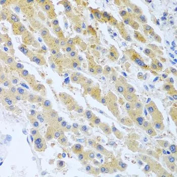 IHC-P analysis of human liver tissue using GTX64588 Stanniocalcin 1 antibody. Dilution : 1:100
