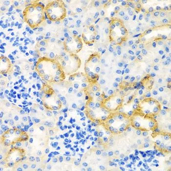 IHC-P analysis of rat kidney tissue using GTX64588 Stanniocalcin 1 antibody. Dilution : 1:100