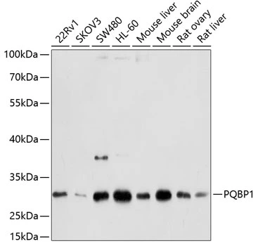 WB analysis of various sample lysates using GTX64597 PQBP1 antibody. Dilution : 1:1000 Loading : 25microg per lane WB analysis of various sample lysates using GTX64597 PQBP1 antibody. Dilution : 1:1000 Loading : 25microg per lane
