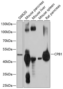 WB analysis of various sample lysates using GTX64600 Carboxypeptidase B antibody. Dilution : 1:1000 Loading : 25microg per lane WB analysis of various sample lysates using GTX64600 Carboxypeptidase B antibody. Dilution : 1:1000 Loading : 25microg per lane