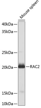 WB analysis of mouse spleen tissue lysate using GTX64601 RAC2 antibody. Dilution : 1:1000 Loading : 25microg per lane WB analysis of mouse spleen tissue lysate using GTX64601 RAC2 antibody. Dilution : 1:1000 Loading : 25microg per lane