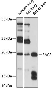 WB analysis of various sample lysates using GTX64601 RAC2 antibody. Dilution : 1:1000 Loading : 25microg per lane