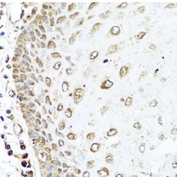 IHC-P analysis of human esophagus tissue using GTX64601 RAC2 antibody. Dilution : 1:100