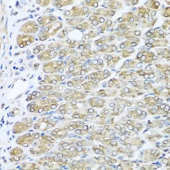 IHC-P analysis of mouse stomach tissue using GTX64601 RAC2 antibody. Dilution : 1:100