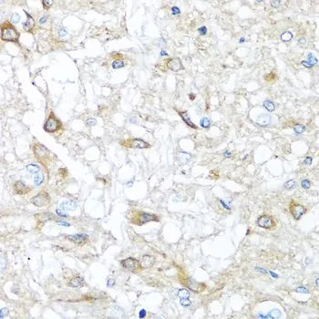 IHC-P analysis of rat brain tissue using GTX64601 RAC2 antibody. Dilution : 1:100