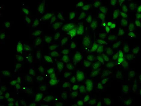 ICC/IF analysis of A549 cells using GTX64606 C1s antibody.