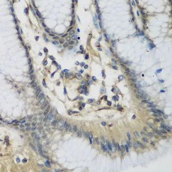 IHC-P analysis of human stomach tissue using GTX64606 C1s antibody. Dilution : 1:200
