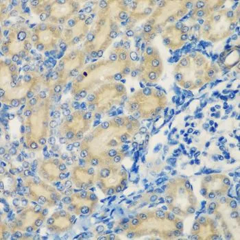 IHC-P analysis of rat kidney tissue using GTX64606 C1s antibody. Dilution : 1:200