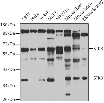 WB analysis of various sample lysates using GTX64607 STK3 antibody. Dilution : 1:1000 Loading : 25microg per lane