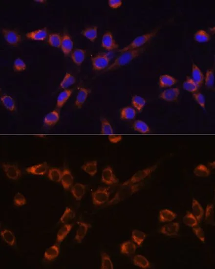 ICC/IF analysis of NIH/3T3 cells using GTX64607 STK3 antibody. Blue : DAPI Dilution : 1:100
