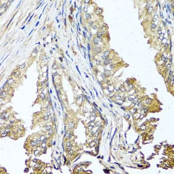 IHC-P analysis of human prostate tissue using GTX64607 STK3 antibody. Dilution : 1:100