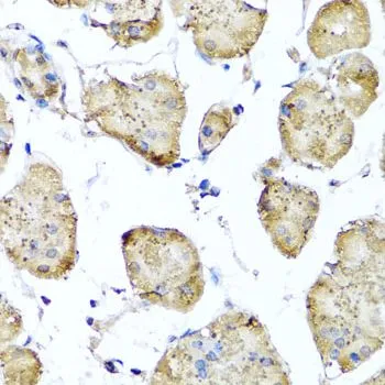 IHC-P analysis of human stomach tissue using GTX64607 STK3 antibody. Dilution : 1:100