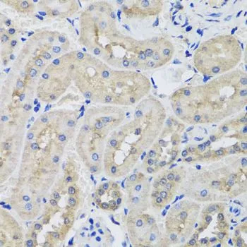 IHC-P analysis of rat kidney tissue using GTX64607 STK3 antibody. Dilution : 1:100