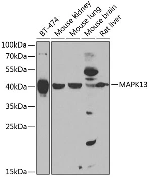 WB analysis of various sample lysates using GTX64610 SAPK4 antibody. The signal was developed with ECL plus-Enhanced. Dilution : 1:1000 Loading : 25microg per lane WB analysis of various sample lysates using GTX64610 SAPK4 antibody. The signal was developed with ECL plus-Enhanced. Dilution : 1:1000 Loading : 25microg per lane