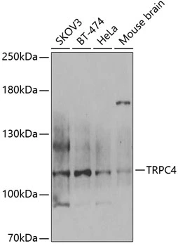 WB analysis of various sample lysates using GTX64614 TRPC4 antibody. Dilution : 1:1000 Loading : 25microg per lane