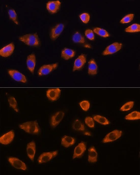 ICC/IF analysis of L929 cells using GTX64622 GNB1 antibody. Blue : DAPI Dilution : 1:100 ICC/IF analysis of L929 cells using GTX64622 GNB1 antibody. Blue : DAPI Dilution : 1:100