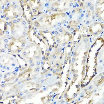IHC-P analysis of rat kidney tissue using GTX64626 HYAL1 antibody. Dilution : 1:100