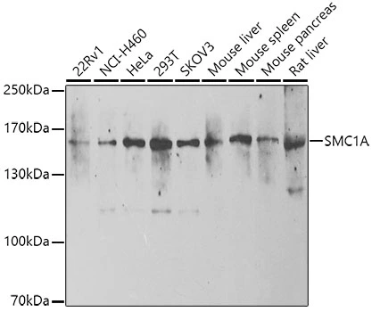 WB analysis of various sample lysates using GTX64627 SMC1A antibody. Dilution : 1:1000 Loading : 25microg per lane WB analysis of various sample lysates using GTX64627 SMC1A antibody. Dilution : 1:1000 Loading : 25microg per lane