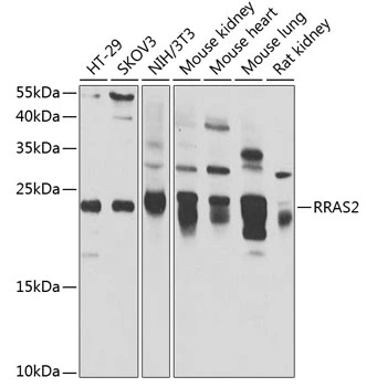 WB analysis of various sample lysates using GTX64628 TC21 antibody. Dilution : 1:1000 Loading : 25microg per lane WB analysis of various sample lysates using GTX64628 TC21 antibody. Dilution : 1:1000 Loading : 25microg per lane