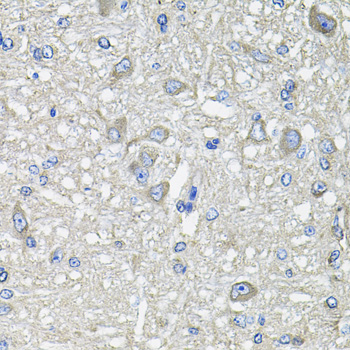 IHC-P analysis of rat brain tissue using GTX64638 GFPT1 antibody. Dilution : 1:100