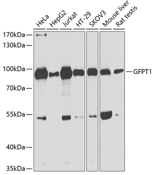 WB analysis of various sample lysates using GTX64638 GFPT1 antibody. Dilution : 1:1000 Loading : 25microg per lane WB analysis of various sample lysates using GTX64638 GFPT1 antibody. Dilution : 1:1000 Loading : 25microg per lane