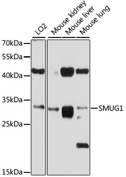 WB analysis of various sample lysates using GTX64640 SMUG1 antibody. The signal was developed with ECL plus-Enhanced. Dilution : 1:1000 Loading : 25microg per lane WB analysis of various sample lysates using GTX64640 SMUG1 antibody. The signal was developed with ECL plus-Enhanced. Dilution : 1:1000 Loading : 25microg per lane