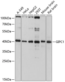 WB analysis of various sample lysates using GTX64641 GIPC1 antibody. Dilution : 1:3000 Loading : 25microg per lane WB analysis of various sample lysates using GTX64641 GIPC1 antibody. Dilution : 1:3000 Loading : 25microg per lane
