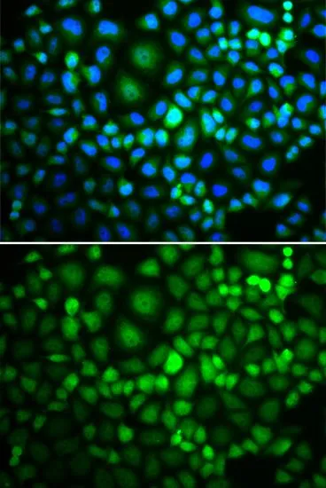 ICC/IF analysis of MCF7 cells using GTX64643 RUVBL2 antibody. Blue : DAPI