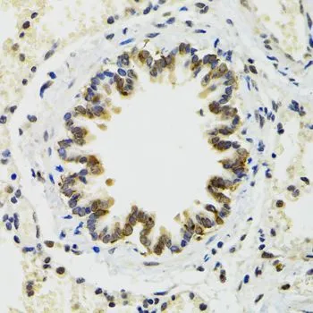 IHC-P analysis of rat lung tissue using GTX64643 RUVBL2 antibody. Dilution : 1:100