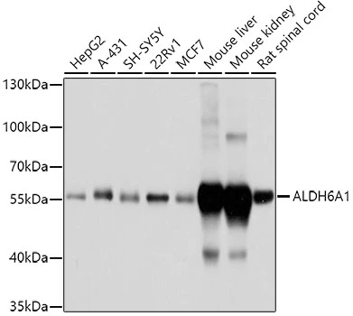 WB analysis of various sample lysates using GTX64647 ALDH6A1 antibody. Dilution : 1:1000 Loading : 25microg per lane WB analysis of various sample lysates using GTX64647 ALDH6A1 antibody. Dilution : 1:1000 Loading : 25microg per lane