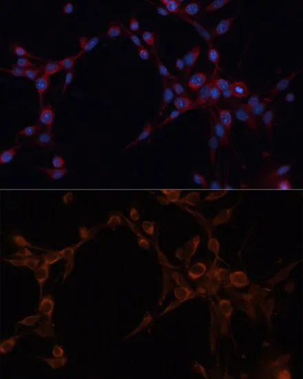 ICC/IF analysis of NIH/3T3 cells using GTX64647 ALDH6A1 antibody. Blue : DAPI Dilution : 1:100