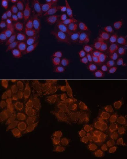 ICC/IF analysis of HeLa cells using GTX64647 ALDH6A1 antibody. Blue : DAPI Dilution : 1:100
