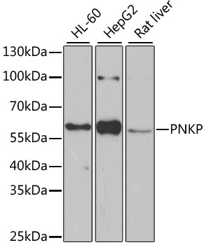WB analysis of various sample lysates using GTX64651 PNK antibody. Dilution : 1:1000 Loading : 25microg per lane WB analysis of various sample lysates using GTX64651 PNK antibody. Dilution : 1:1000 Loading : 25microg per lane