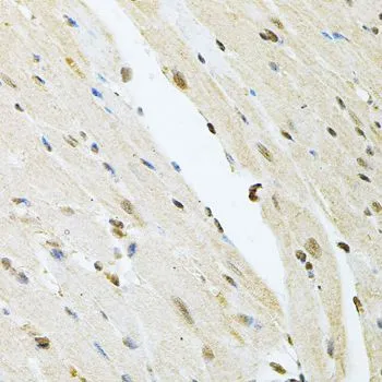 IHC-P analysis of mouse heart tissue using GTX64651 PNK antibody. Dilution : 1:100