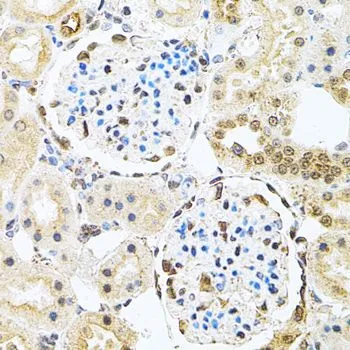 IHC-P analysis of rat kidney tissue using GTX64651 PNK antibody. Dilution : 1:100