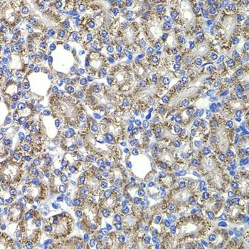 IHC-P analysis of rat kidney tissue using GTX64652 TRIP15 antibody. Dilution : 1:100