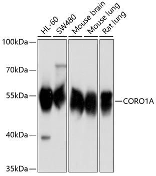 WB analysis of various sample lysates using GTX64657 Coronin 1A antibody. Dilution : 1:1000 Loading : 25microg per lane WB analysis of various sample lysates using GTX64657 Coronin 1A antibody. Dilution : 1:1000 Loading : 25microg per lane