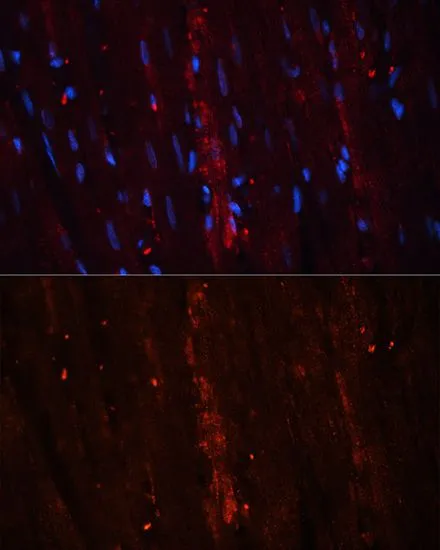 IHC-P analysis of rat heart tissue using GTX64657 Coronin 1A antibody. Blue : DAPI Dilution : 1:100