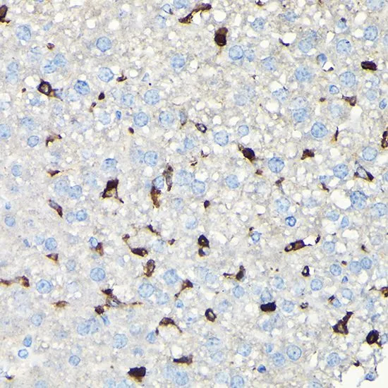 IHC-P analysis of mouse liver tissue using GTX64657 Coronin 1A antibody. Dilution : 1:100