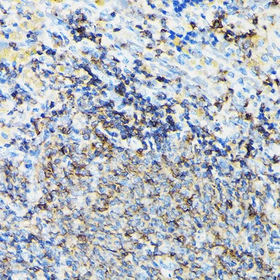 IHC-P analysis of rat spleen tissue using GTX64657 Coronin 1A antibody. Dilution : 1:100