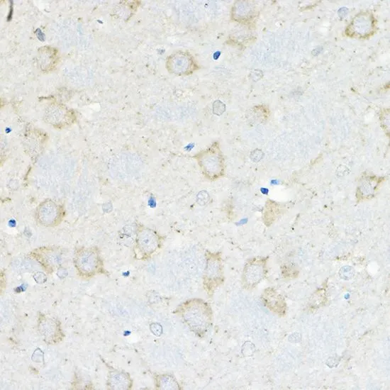IHC-P analysis of rat brain tissue using GTX64658 GIPR antibody. Dilution : 1:200