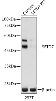 WB analysis of 293T cell lysate using GTX64659 SETD7 antibody. Dilution : 1:1000 Loading : 25microg per lane WB analysis of 293T cell lysate using GTX64659 SETD7 antibody. Dilution : 1:1000 Loading : 25microg per lane