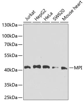 WB analysis of various sample lysates using GTX64661 MPI antibody. Dilution : 1:1000 Loading : 25microg per lane WB analysis of various sample lysates using GTX64661 MPI antibody. Dilution : 1:1000 Loading : 25microg per lane