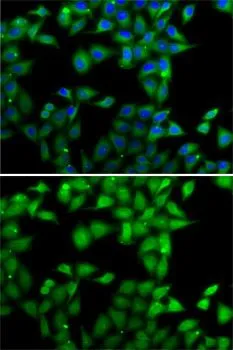 ICC/IF analysis of MCF7 cells using GTX64661 MPI antibody. Blue : DAPI